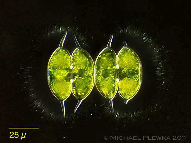 plingfactory Leben im Teich Staurodesmus sp..(Conjugatophyceae)